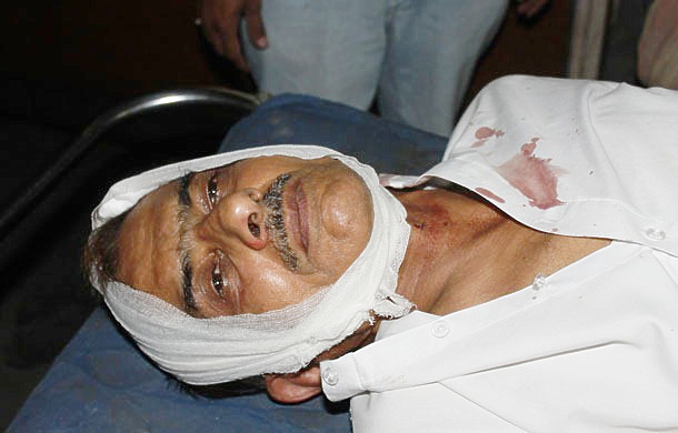 Hatim Rocketwala sustained serious head injuries.